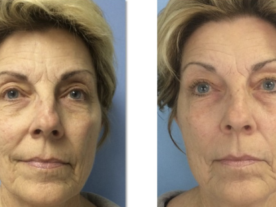 Screenshot 2025-03-04 at 4.36.37 PM